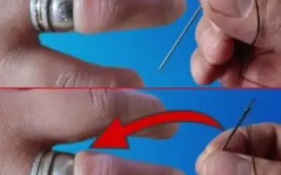 Comment retirer facilement une bague coincee sur votre doigt avec une aiguille.jpg